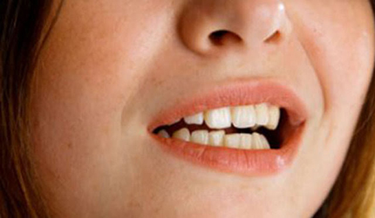 Çene Sıkma Hastalığı Belirtileri ve Tedavisi